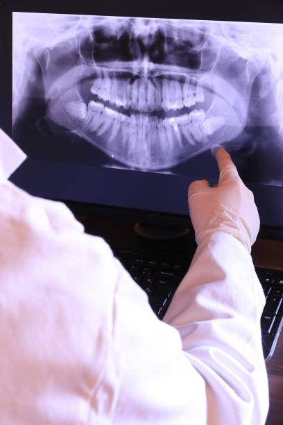 Best Emergency Root Canal Treatment in Willis, TX